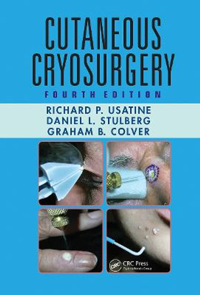 Cutaneous Cryosurgery by Richard P. Usatine