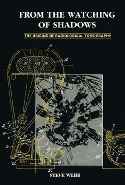 From the Watching of Shadows: The Origins of Radiological Tomography by Steve Webb