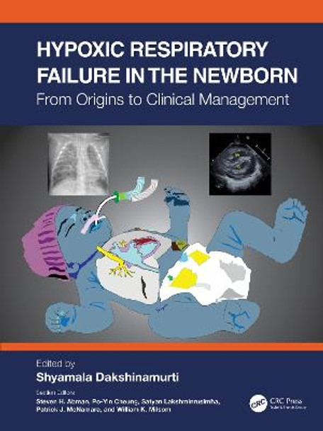 Hypoxic Respiratory Failure in the Newborn: From Origins to Clinical Management by Shyamala Dakshinamurti