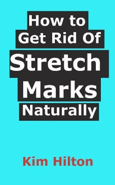 How to Get Rid Of Stretch Marks Naturally by Kim Hilton 9781521109120