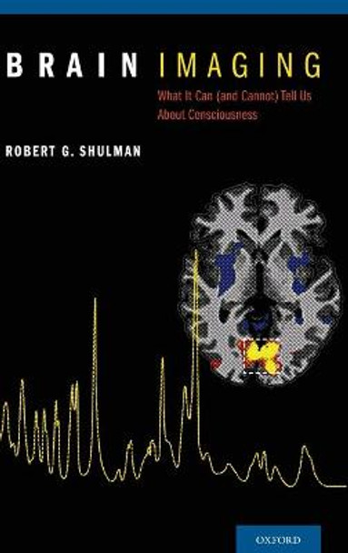 Brain Imaging: What it Can (and Cannot) Tell Us About Consciousness by Robert G. Shulman