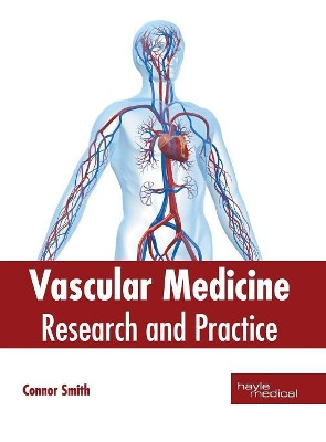 Vascular Medicine: Research and Practice by Connor Smith 9781632415585