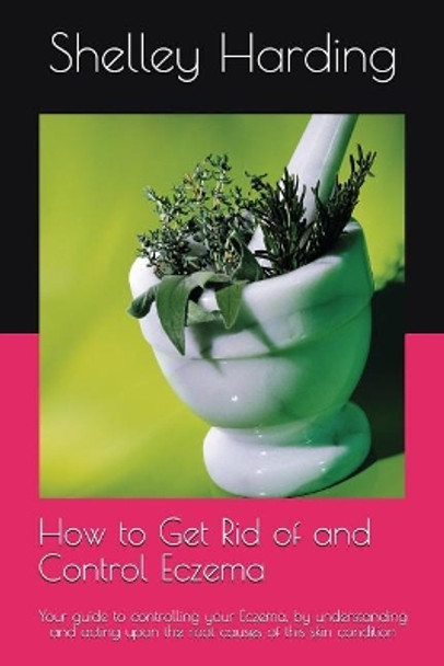 How to Get Rid of and Control Eczema: Your Guide to Controlling Your Eczema, by Understanding and Acting Upon the Root Causes of This Skin Condition by Shelley Harding 9781521045046