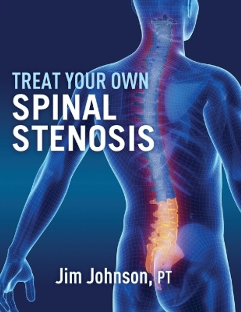 Treat Your Own Spinal Stenosis by Jim Johnson 9781642379587