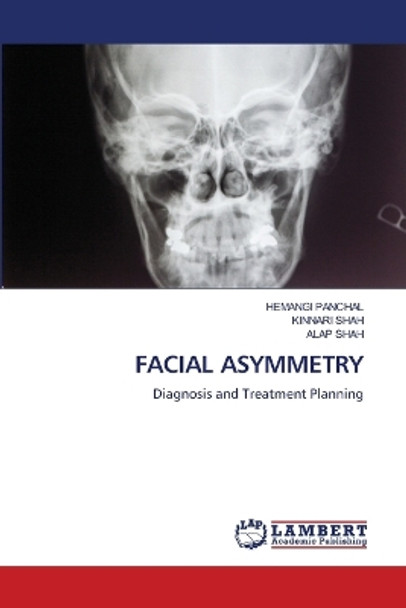 Facial Asymmetry by Hemangi Panchal 9786206148890