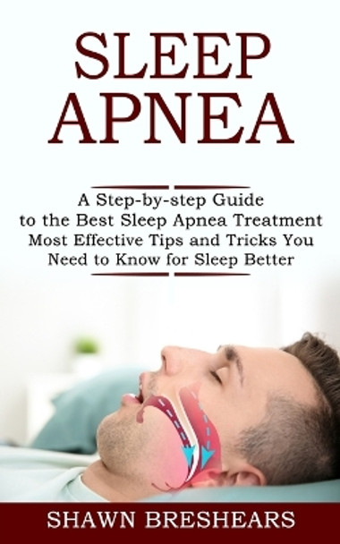 Sleep Apnea: A Step-by-step Guide to the Best Sleep Apnea Treatment (Most Effective Tips and Tricks You Need to Know for Sleep Better) by Shawn Breshears 9781990268342