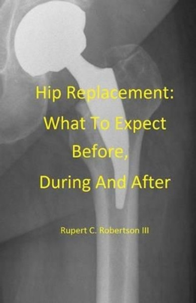 Hip Replacement: What To Expect Before, During and After by Rupert C Robertson 9781517462307