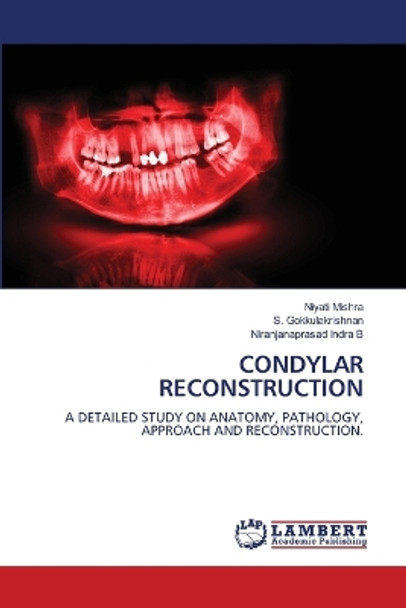 Condylar Reconstruction by Niyati Mishra 9786205631171