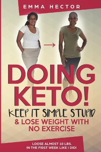 Doing KETO? Keep it simple stupid!: Easily loose loads of weight by doing keto like I did! by Emma J Hector 9781721902590