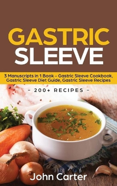 Gastric Sleeve: 3 Manuscripts in 1 Book - Gastric Sleeve Cookbook, Gastric Sleeve Diet Guide, Gastric Sleeve Recipes by John Carter 9781951103958