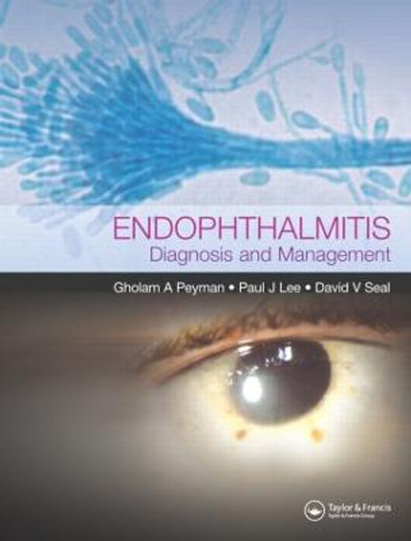 Endophthalmitis: Diagnosis and Treatment by Paul J. Lee