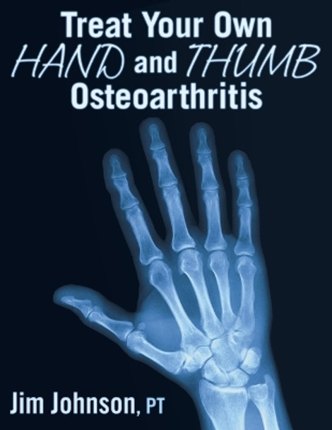 Treat Your Own Hand and Thumb Osteoarthritis by Jim Johnson 9781642376470