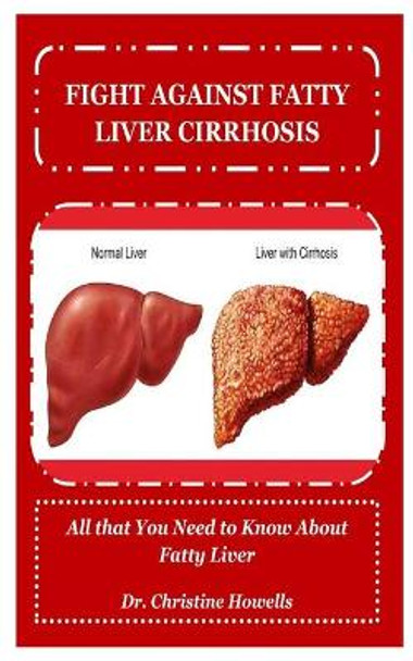 Fight Against Fatty Liver Cirrhosis: All that You Need to Know About Fatty Liver by Dr Christine Howells 9781671107182