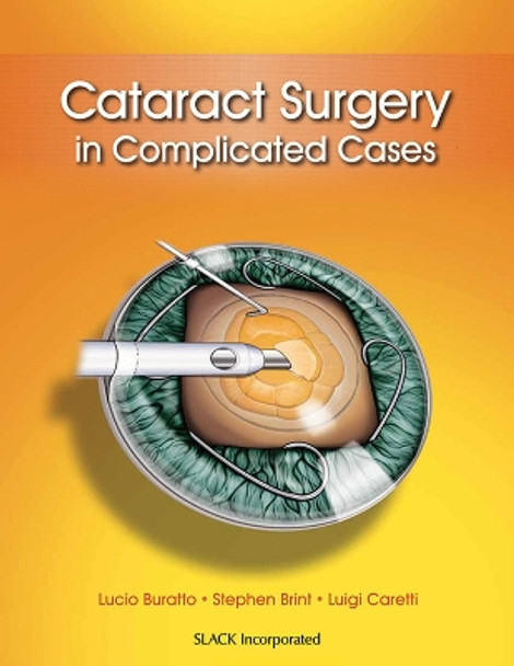 Cataract Surgery in Complicated Cases by Lucio Buratto 9781617116070