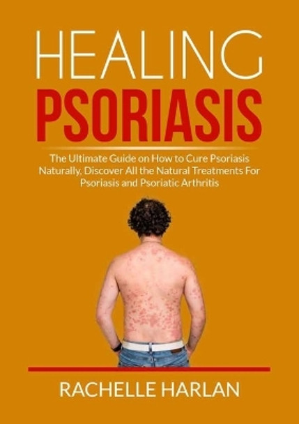 Healing Psoriasis: The Ultimate Guide on How to Cure Psoriasis Naturally, Discover All the Natural Treatments For Psoriasis and Psoriatic Arthritis by Rachelle Harlan 9786069837566