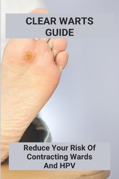 Clear Warts Guide: Reduce Your Risk Of Contracting Wards And Hpv: Does Duct Tape Get Rid Of Warts by Maximina Macaraeg 9798738873980