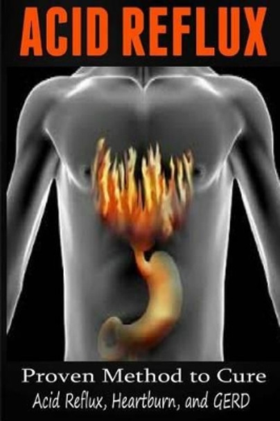 Acid Reflux: Proven Methods to Cure Acid Reflux, Heartburn, and GERD by Anthony Wilkenson 9781505713954