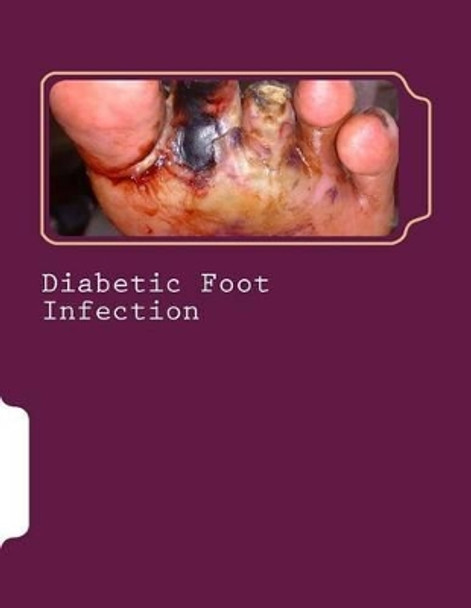 Diabetic Foot Infection by Syed Shahmeer Raza 9781519448781