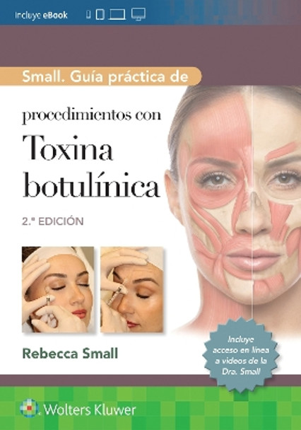 Small. Guía práctica de procedimientos con toxina botulínica Rebecca Small 9788410022270