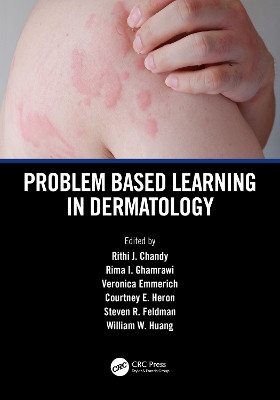 Problem Based Learning in Dermatology Rithi John Chandy 9781032571362