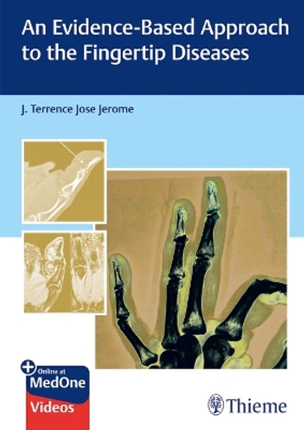 An Evidence-Based Approach to the Fingertip Diseases J Terrence Jerome 9789392819360