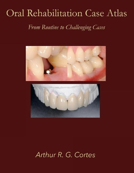 Oral Rehabilitation Case Atlas: From Routine to Challenging Cases by Arthur R G Cortes 9781974427000