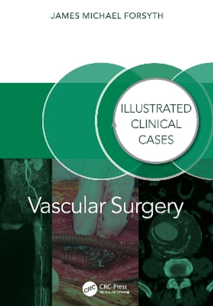 Vascular Surgery:: Illustrated Clinical Cases James Forsyth 9781032804828