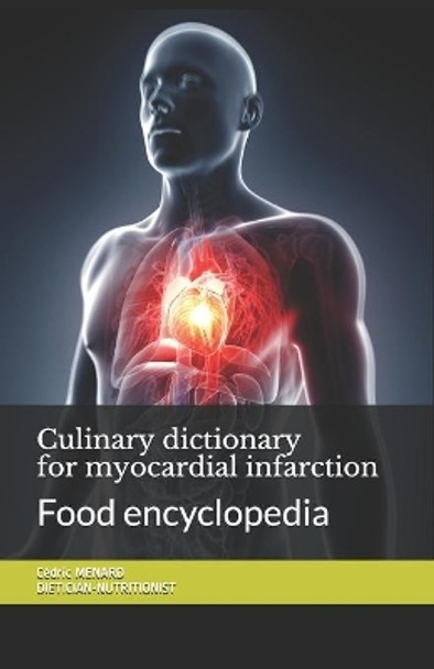 Culinary dictionary for myocardial infarction: Food encyclopedia by Cedric Menard 9798698058052