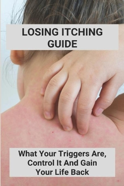 Losing Itching Guide: What Your Triggers Are, Control It And Gain Your Life Back: Stretch Marks Itch When Losing Weight by Scottie Janek 9798737781224