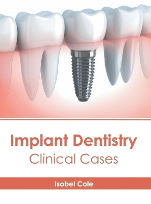 Implant Dentistry: Clinical Cases by Isobel Cole 9798887406442