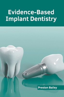 Evidence-Based Implant Dentistry by Preston Bailey 9798887401157