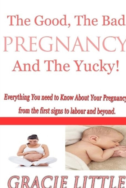 Pregnancy: The ins and outs, the ups and downs: What to expect from the first signs of pregnancy and pregnancy symptoms right through to labour and the fourth trimester by Gracie Little 9781491294666