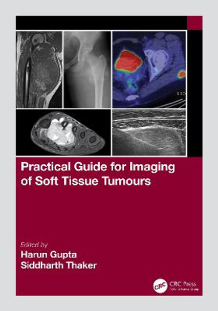 Practical Guide for Imaging of Soft Tissue Tumours by Harun Gupta