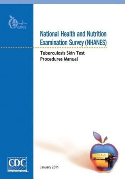 National Health and Nutrition Examination Survey (Nhanes): Tuberculosis Skin Test Procedures Manual by Centers for Disease Cont And Prevention 9781499258769