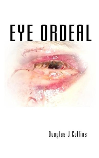 Eye Ordeal by Douglas J Collins 9781983603600