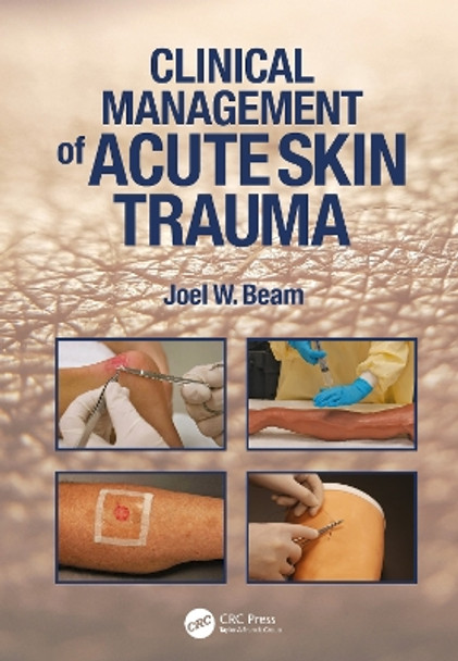 Clinical Management of Acute Skin Trauma by Joel W. Beam 9781638220664