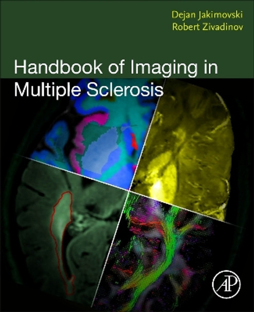 Handbook of Imaging in Multiple Sclerosis Dejan Jakimovski 9780323957397