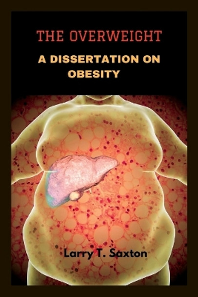 The Overweight: A Dissertation on Obesity by Larry T Saxton 9798362177096