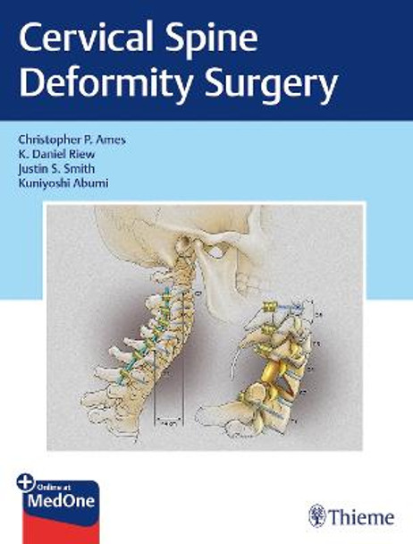 Cervical Spine Deformity Surgery by Christopher Ames