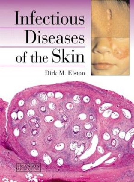 Infectious Diseases of the Skin by Dirk M. Elston