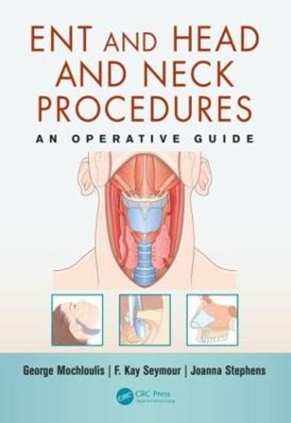 ENT and Head and Neck Procedures: An Operative Guide by George Mochloulis