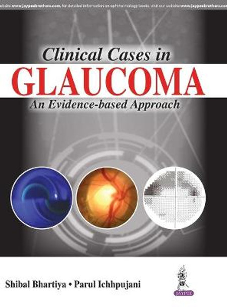 Clinical Cases in Glaucoma: An Evidence Based Approach by Shibal Bhartiya
