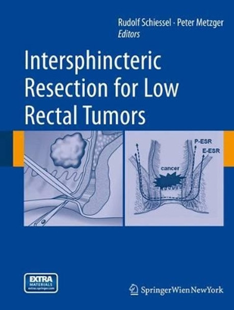 Intersphincteric Resection for Low Rectal Tumors by Rudolf Schiessel 9783709109281 [USED COPY]