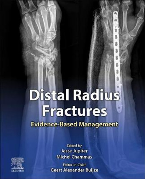 Distal Radius Fractures: Evidence-Based Management by Geert Buijze