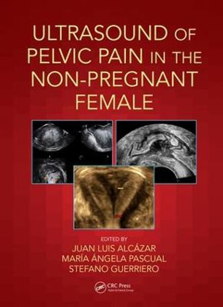 Ultrasound of Pelvic Pain in the Non-Pregnant Patient by Juan Luis Alcazar