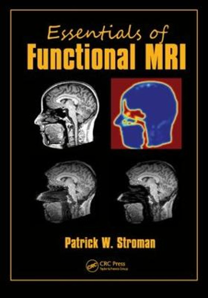 Essentials of Functional MRI by Patrick W. Stroman