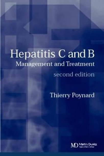 Hepatitis B and C: Management and Treatment by Thierry Poynard