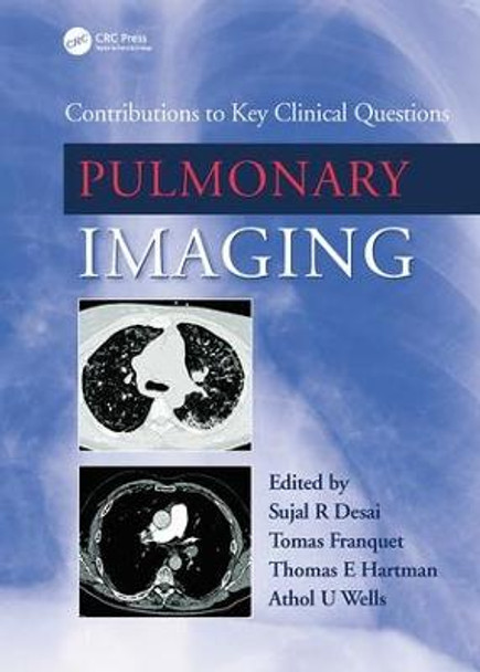 Pulmonary Imaging: Contributions to Key Clinical Questions by Sujal R. Desai