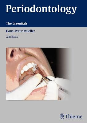 Periodontology: The Essentials by Hans-Peter Mueller