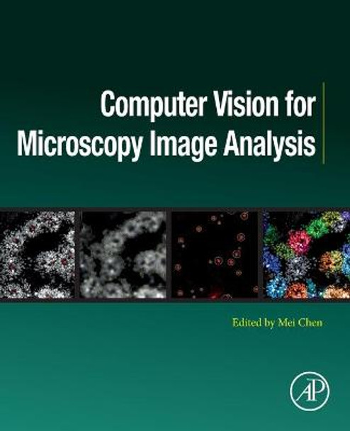 Computer Vision for Microscopy Image Analysis by Mei Chen